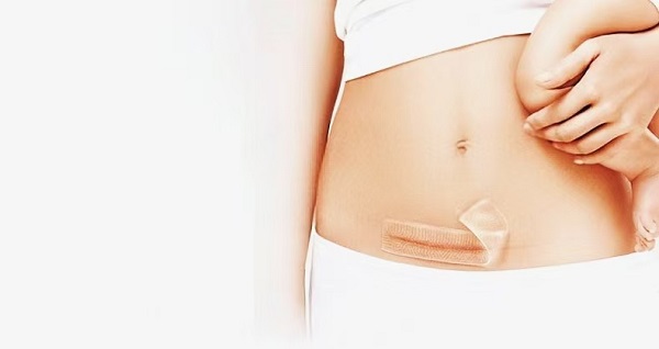 ထူထဲသော Silicone Gel အမာရွတ်စာရွက်များ အဘယ်ကြောင့် လူကြိုက်များသနည်း။