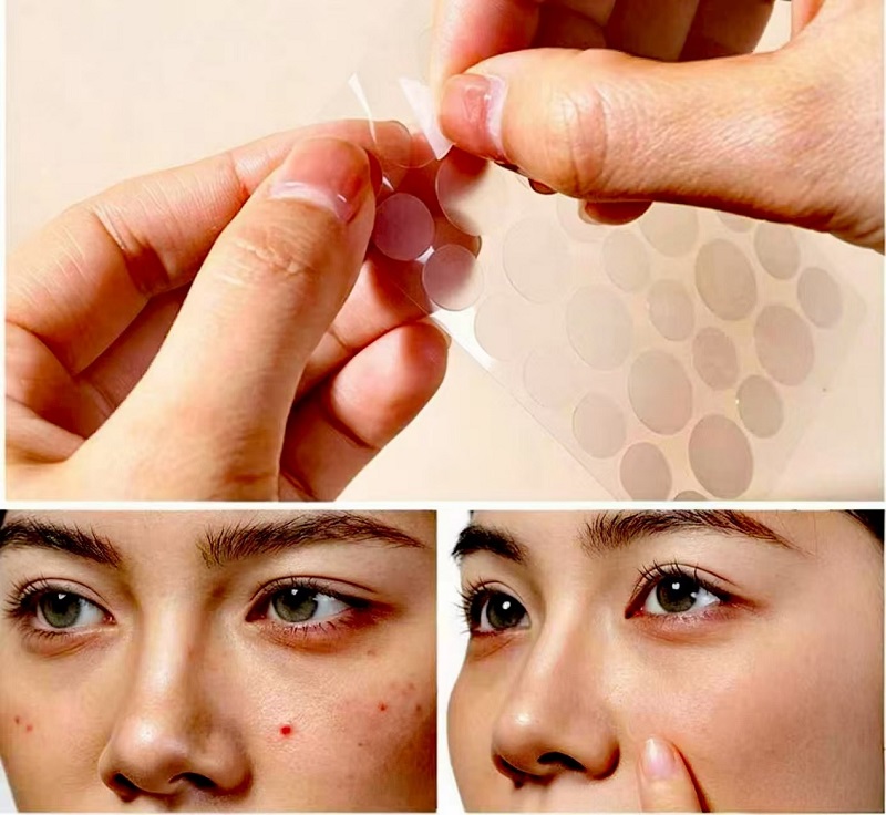 အများဆုံးရလဒ်များအတွက် CmallBio Pimple Patches ကို ညတွင်းချင်း မည်သို့အသုံးပြုရမည်နည်း။