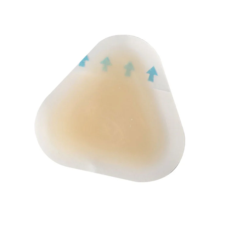 ခြေဖနောင့်အတွက် မြုံနေသော အရည်ကြည်ဖုများကို ကာကွယ်ခြင်း။