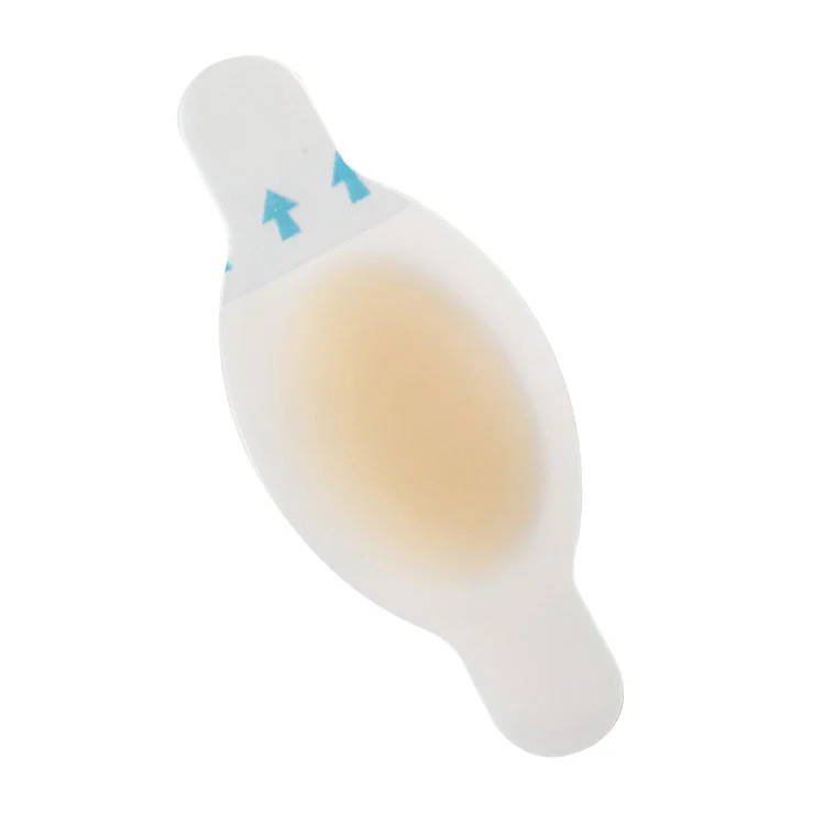 ခြေထောက်အဖုအပိမ့်များကို ကာကွယ်ရန်အတွက် ရေဒဏ်ခံနိုင်သော Hydrocolloid ပတ်တီးများ